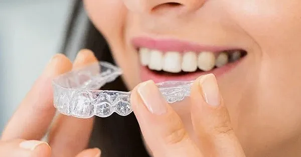 5-things-parents-need-to-know-about-invisalign-in-san-francisco
