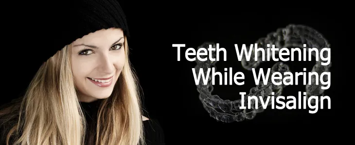 Teeth Whitening While Wearing Invisalign