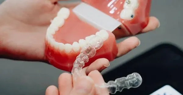 Difference Between Adult Invisalign and Teen