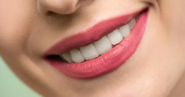 Get the Facts: Is Cosmetic Dentistry in San Francisco Right for You?