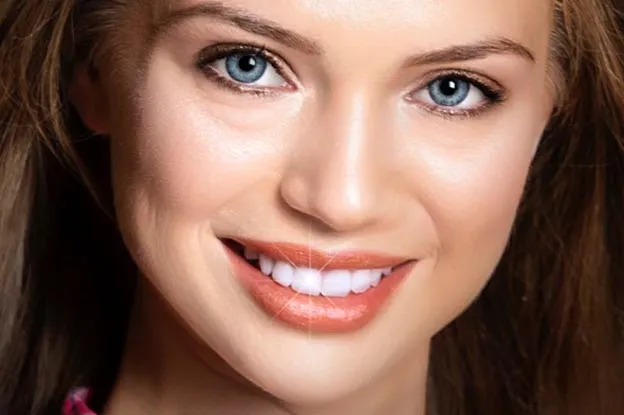 How to Keep Your Smile After Cosmetic Dentistry | San Francisco