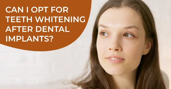 Can I Opt for Teeth Whitening After a Dental Implants?