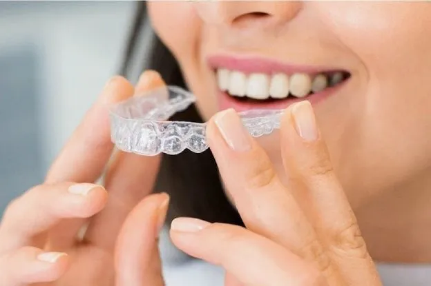 What I Should Know About Invisalign