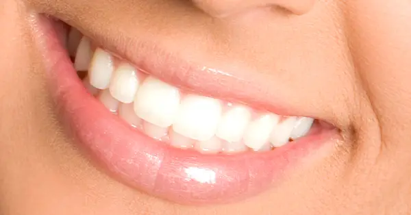 Why Whitening Results Vary | San Francisco Dentist Helpful dental information about teeth whitening San Francisco